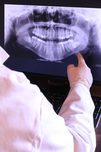 Best Emergency Dental Care for Abscessed Tooth in Fayette, IA