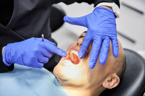 Best Emergency Dentist for Lost Fillings or Crowns in Fayette, IA
