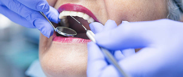 Best Emergency Dentist for Knocked-Out Tooth in Fayette, IA