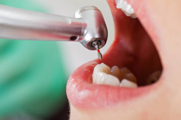 Best Pediatric Emergency Dentist in Fayette, IA